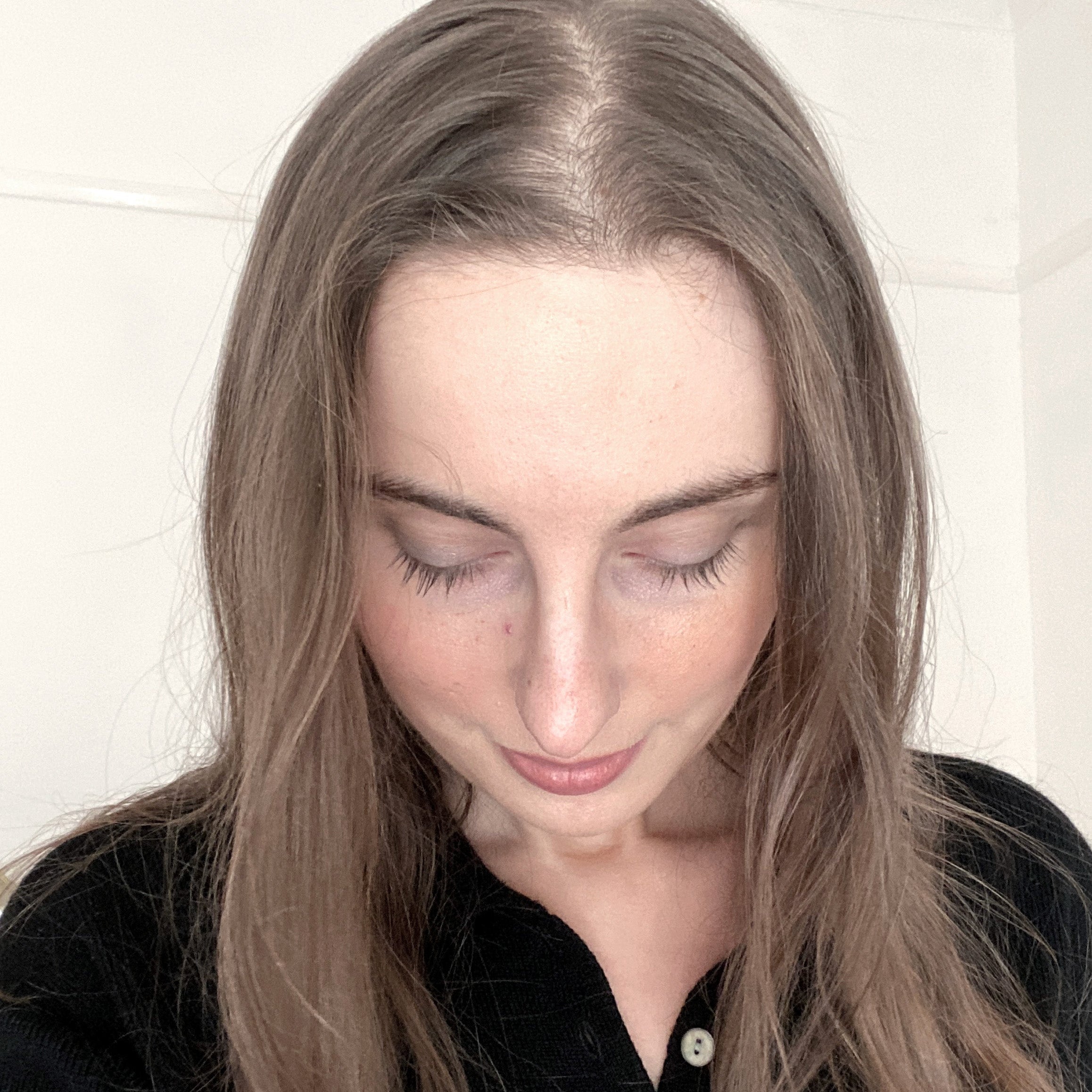 Living With Female Pattern Hair Loss & Androgenic Alopecia